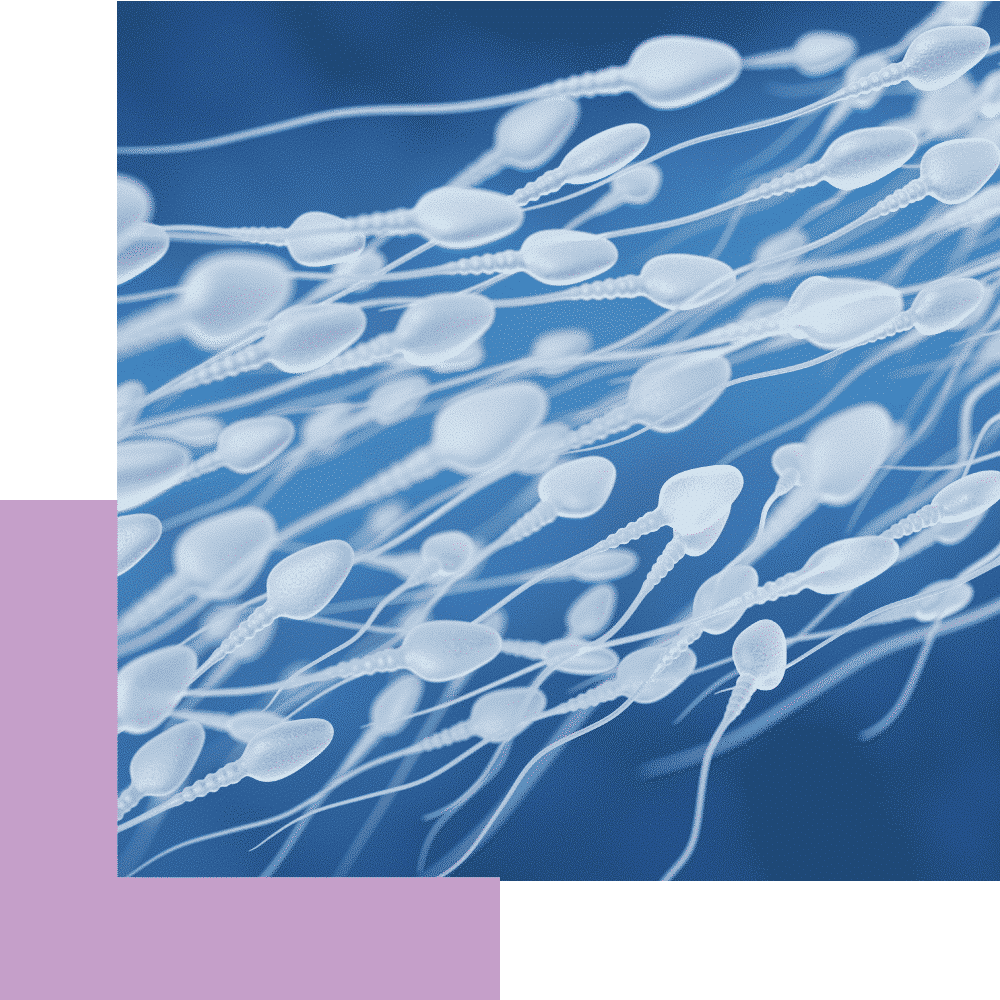iolife.eu - Φλεγμονή γεννητικού συστήματος - Φωτογραφία σπέρματος από μισκροσκόπιο