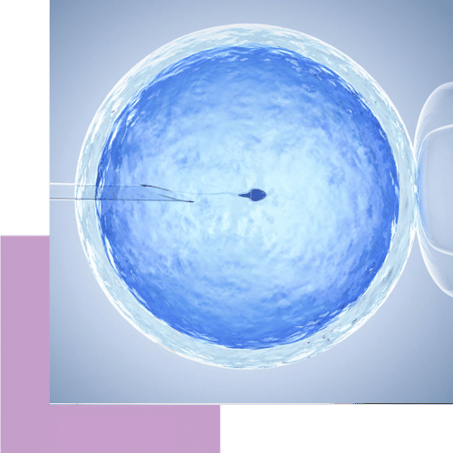 imi fusikos kyklos mini ivf 2-internal