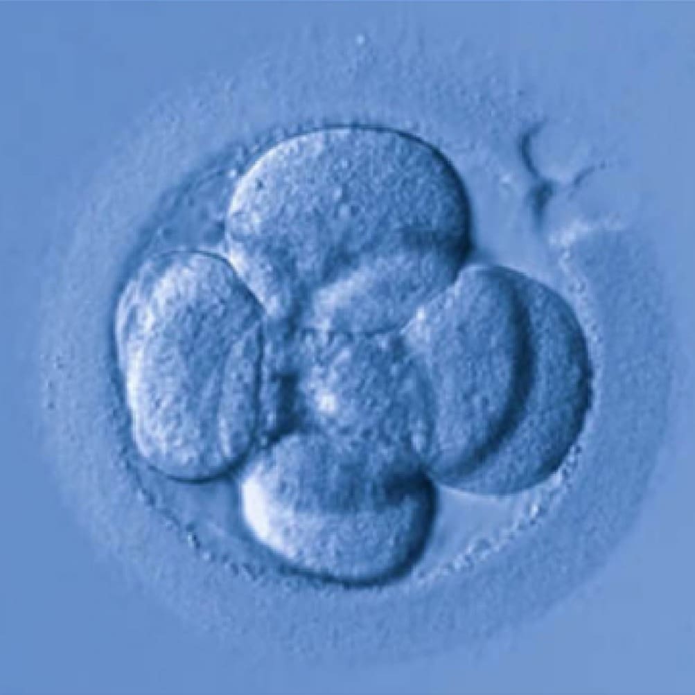 Υποβοηθούμενη εκκόλαψη εμβρύων (LAZT) και βλαστοκύστεων (LAH) με χρήση εξελιγμένου Laser (Octax Navilase) iolife