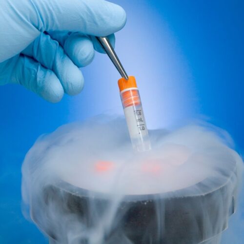 1-Testicular tissue 1-Testicular tissue