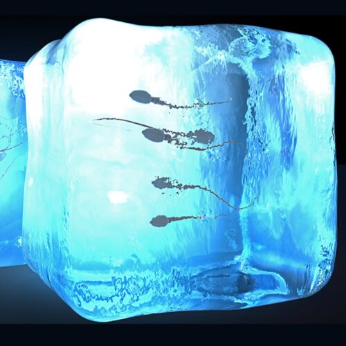 3-sperm Freezing 3-sperm Freezing